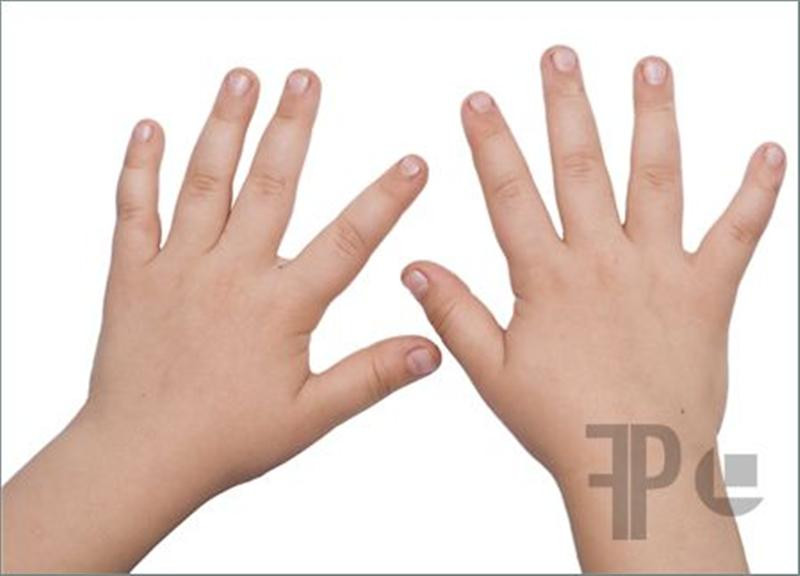 Hands-1023415 (Medium)