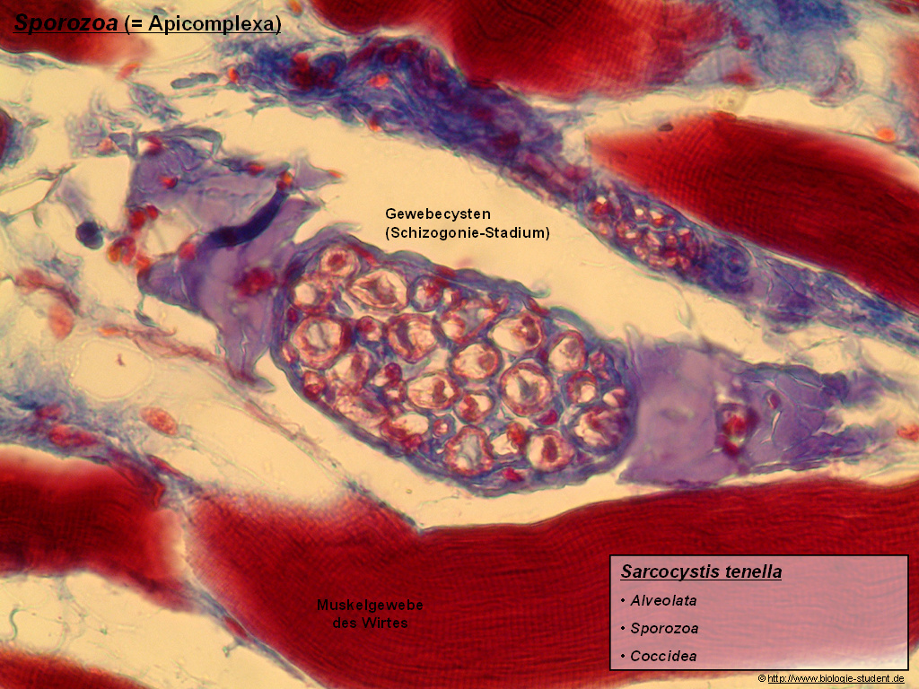 sarcocystis tenella2 (Ov)